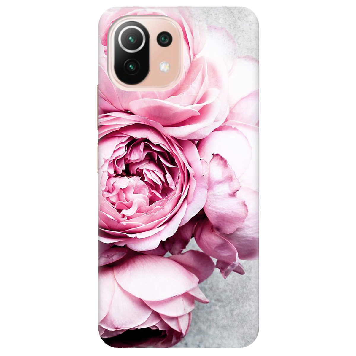 Чохол для Xiaomi Mi 11 lite Peony - фото 1 - Чохли для телефонів