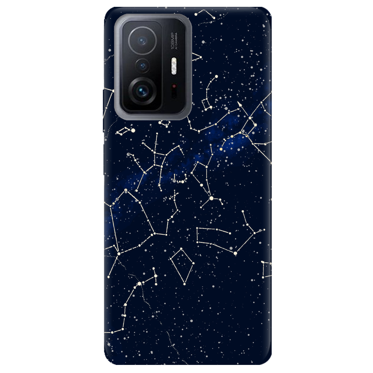 Чехол для Xiaomi 11T Stardom - фото 1 - Чехлы для телефонов