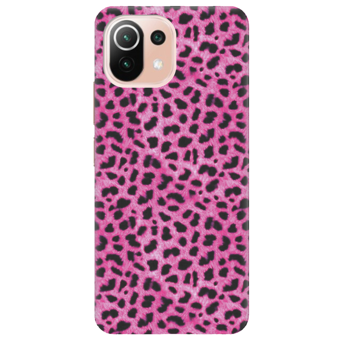 Чехол для Xiaomi Mi 11 lite Pink Leopard - фото 1 - Чехлы для телефонов