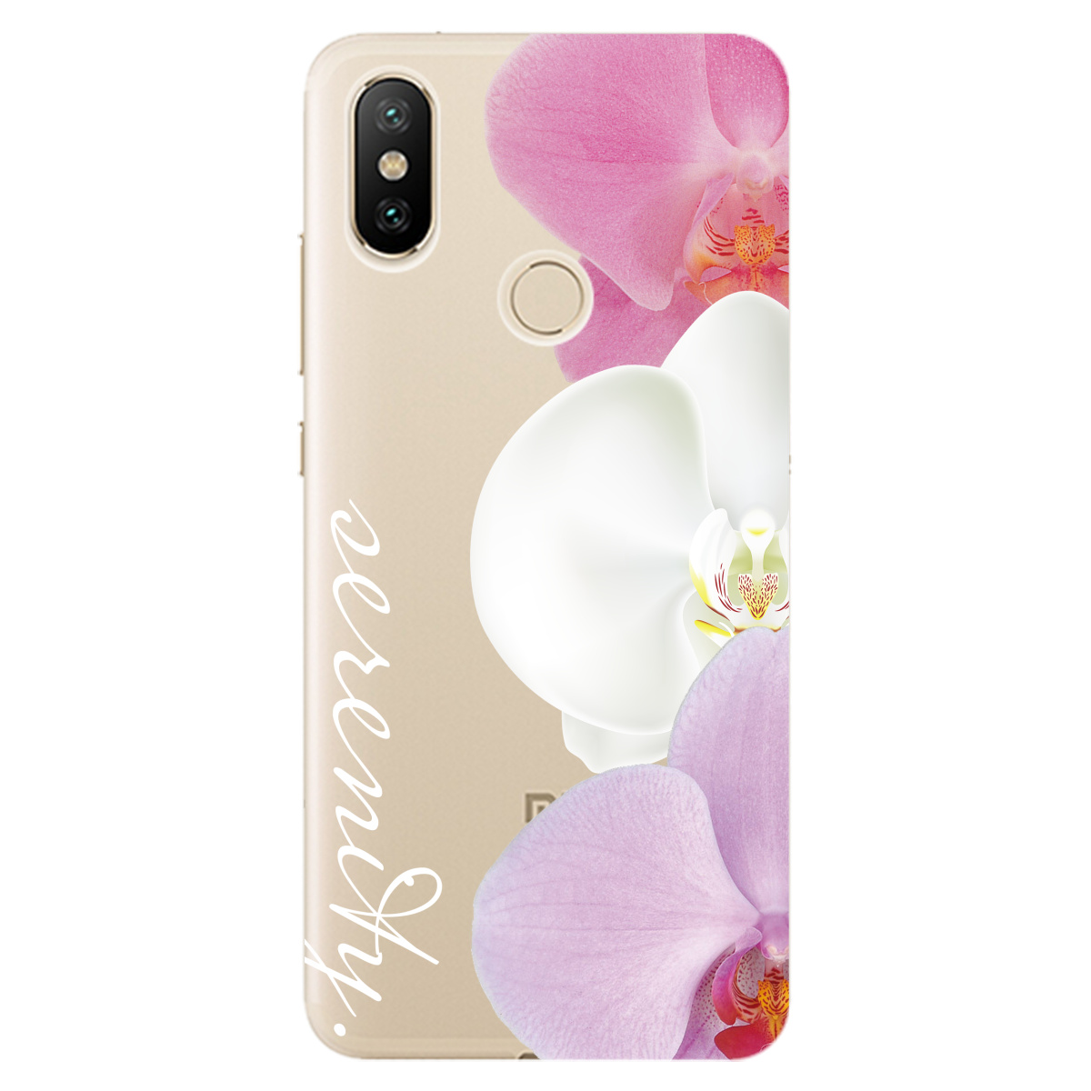 Чехол для Xiaomi Mi A2 Lite Безтурботність - фото 1 - Чехлы для телефонов